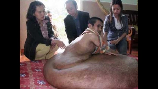 of 186 pound. man pleads for