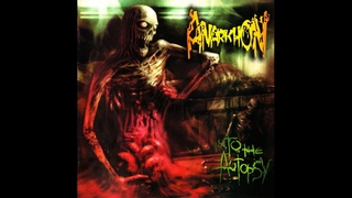 Anarkhon - Into the Autopsy (Full Album)