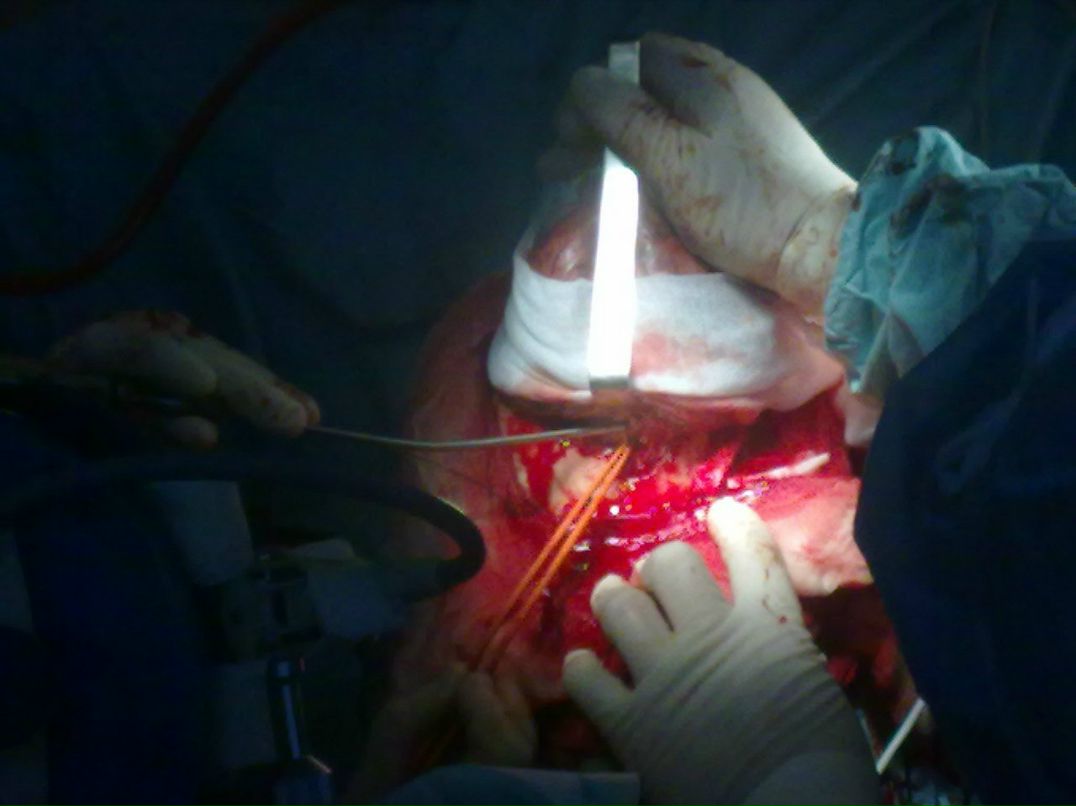 Эльгюн Мамедов | Москва