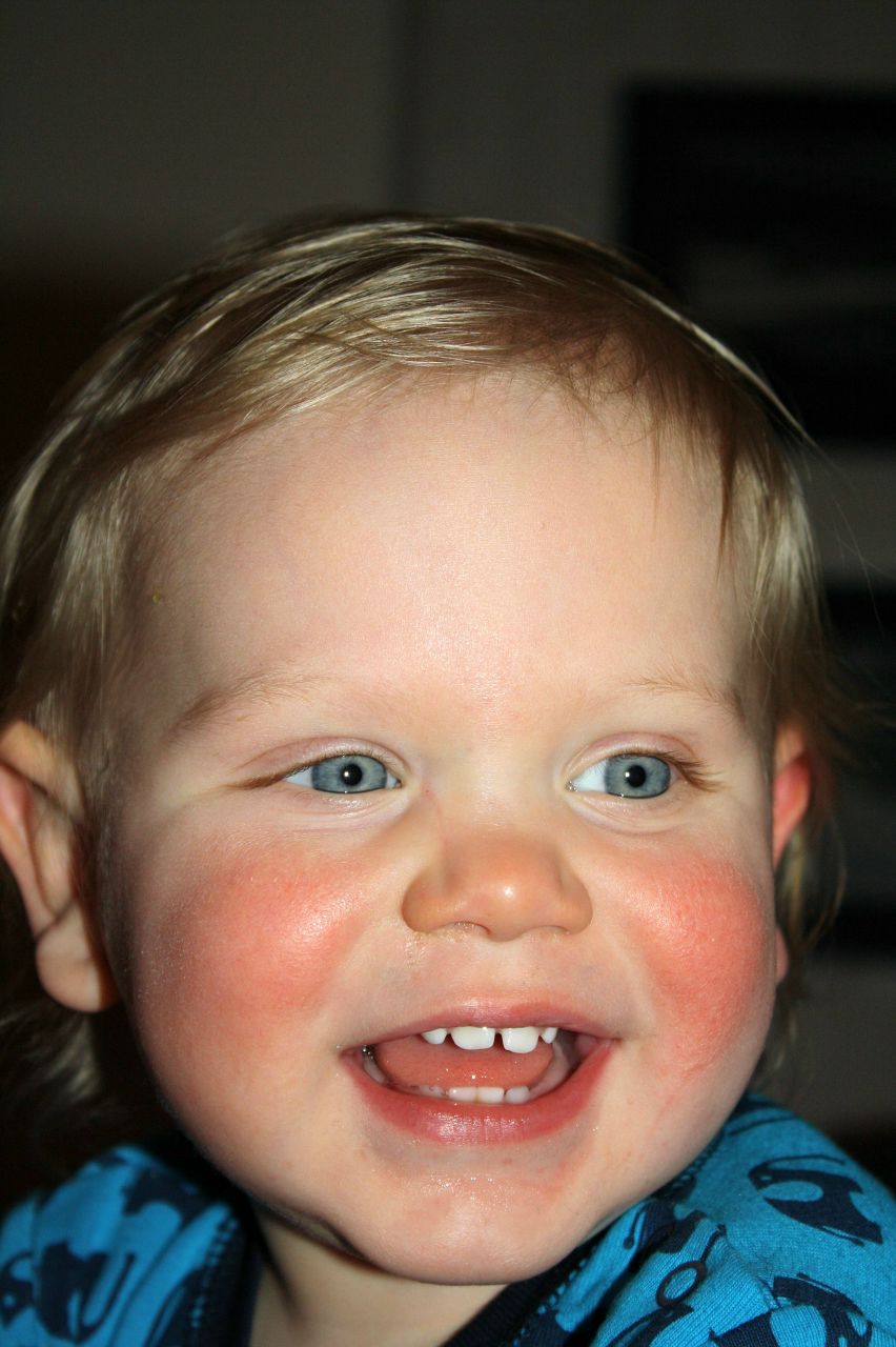 Jelena Jakobsson | Umeå