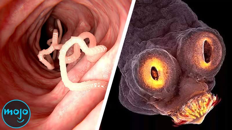 Top 10 Grossest Parasites ( And What They Do To Your