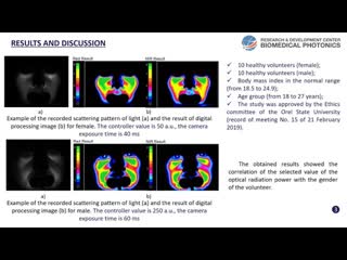 Bryanskaya E. Brightness Controller Optimization for the Digital Diaphanoscopy System